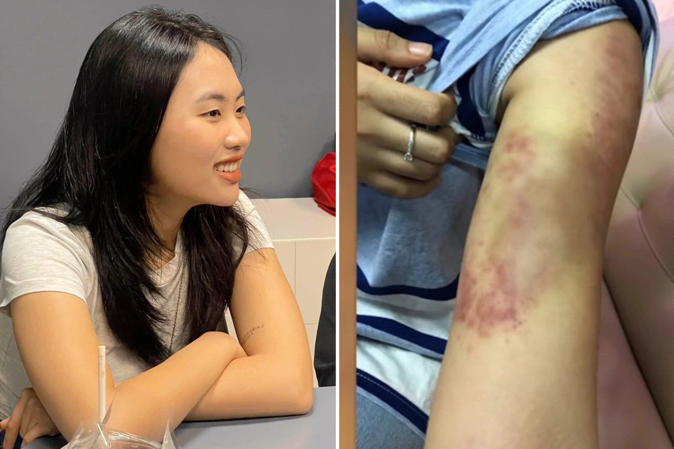 Giải trí - Giảm cân sai cách: 'Ngọc nữ' Lan Ngọc nhập viện, Phương Mỹ Chi bầm tím cơ thể (Hình 7).