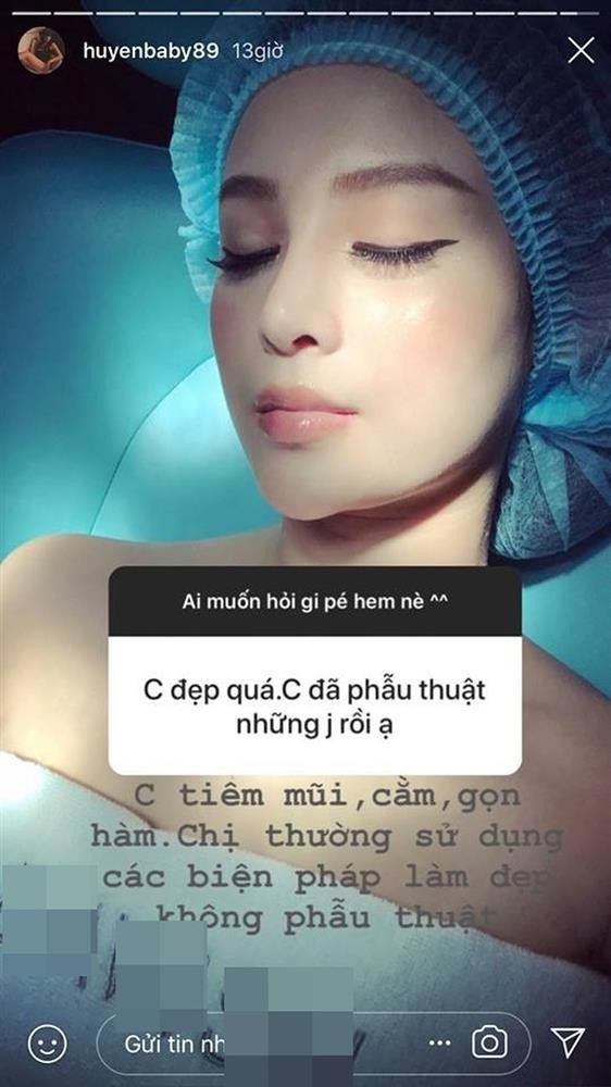 Giải trí - Vợ sắp cưới của Quang Hải công khai chỉnh sửa một điểm trên mặt nhằm có nét đẹp 'ngọc nữ' (Hình 8).