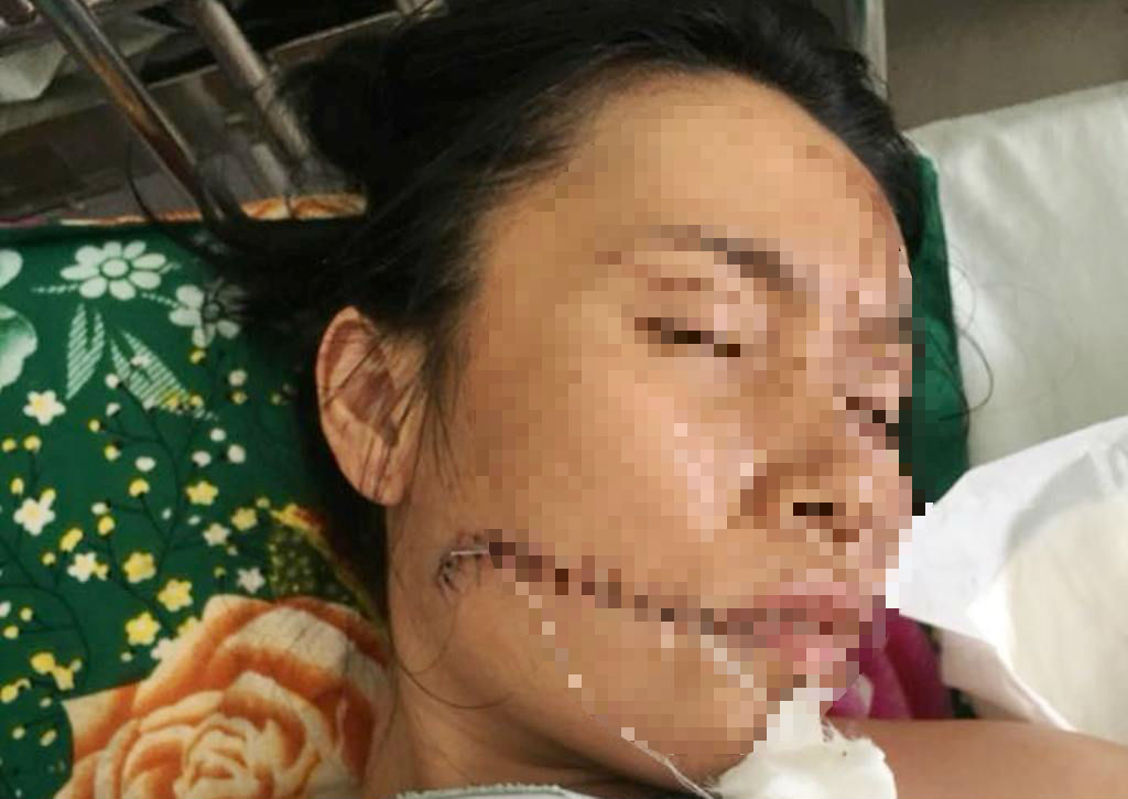 Uẩn khúc phía sau vụ người đàn ông phóng hỏa đốt nhân tình rồi tự thiêu (Hình 5).