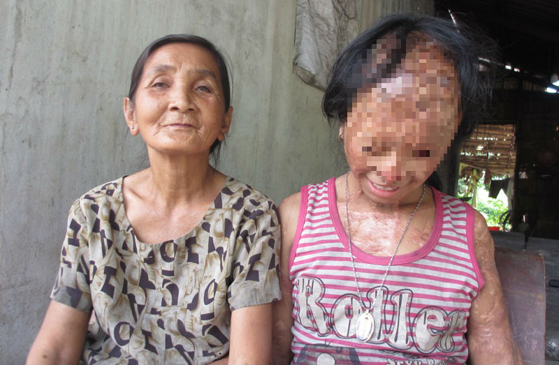 Hồ sơ điều tra - Bà nội cháu bé bị tạt axít muốn xin đôi mắt của tử tù Nguyễn Hữu Tình