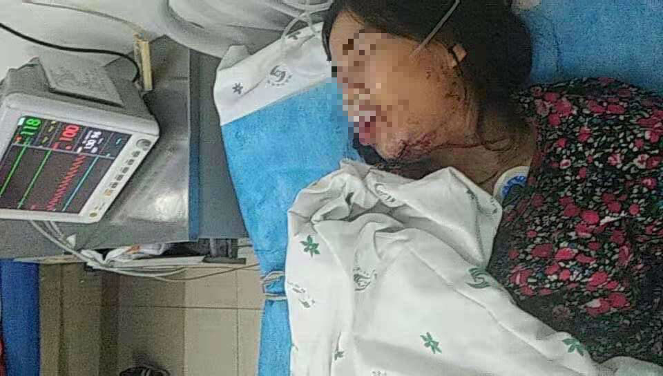 Cộng đồng mạng - Sự thật bất ngờ về thông tin cô dâu Việt bị chồng bạo hành đến nhập viện