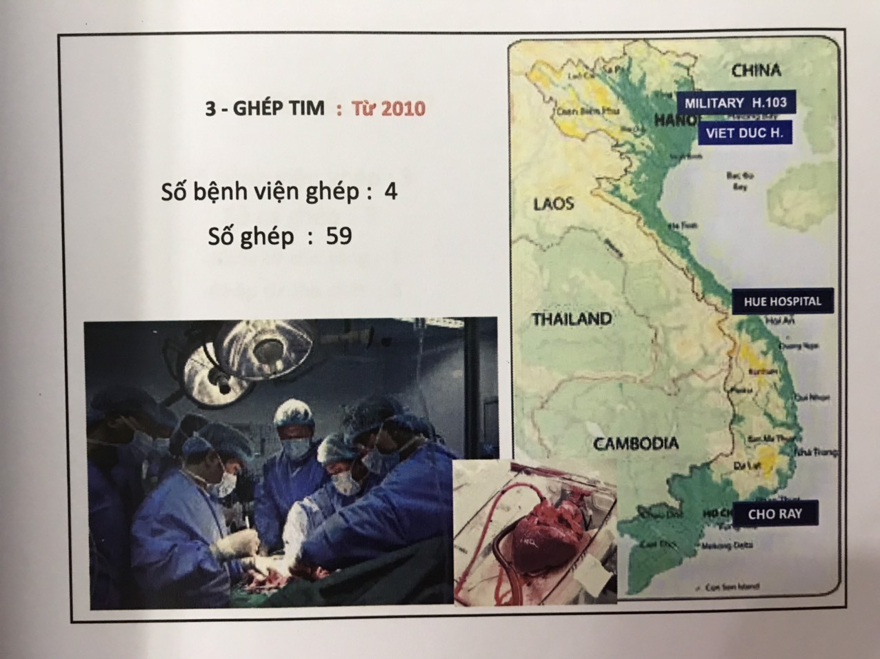 Sức khỏe - Thiếu nguồn tạng, nạn mua bán tạng - thách thức của ngành ghép tạng (Hình 3).