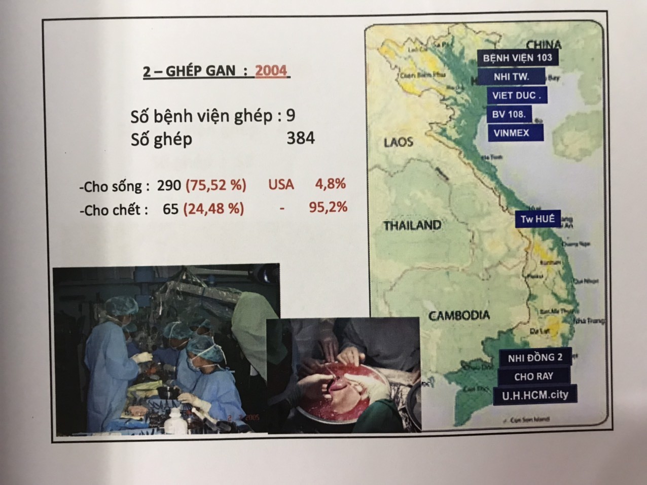 Sức khỏe - Thiếu nguồn tạng, nạn mua bán tạng - thách thức của ngành ghép tạng (Hình 4).