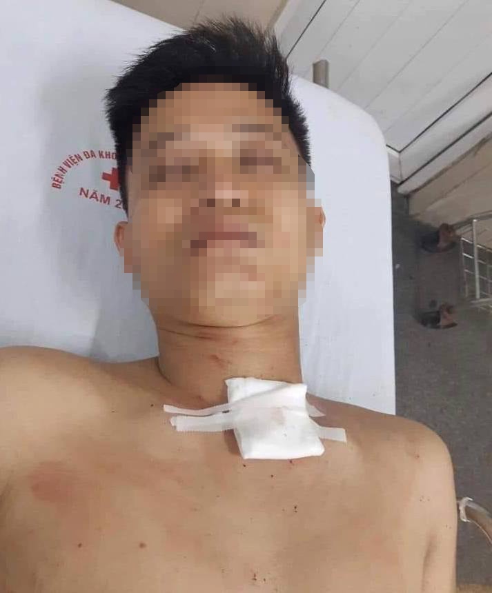 An ninh - Hình sự - Nghi án mâu thuẫn tình cảm, nam thanh niêm đâm chết bạn gái rồi tự tử (Hình 2).