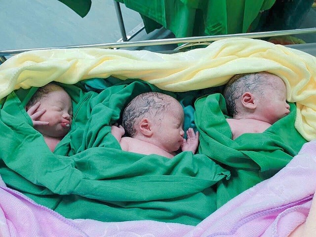 Sức khỏe - Hi hữu: Siêu âm thai đôi cả thai kỳ, bác sĩ mổ được 3 bé gái đáng yêu