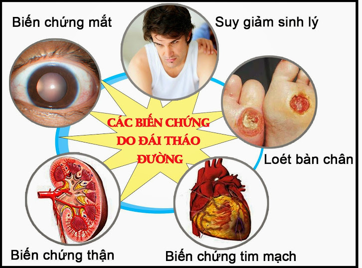 Sức khỏe - NSND Anh Tú mắc căn bệnh nguy hiểm “cứ 6 giây lại có một người tử vong” (Hình 2).