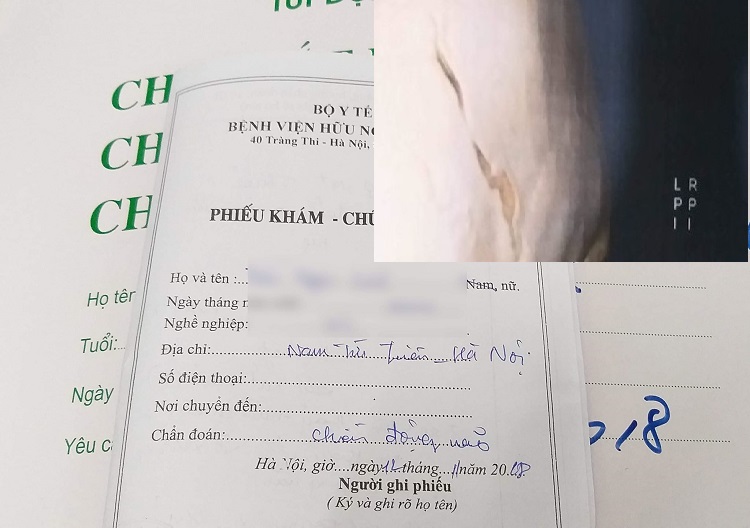 An ninh - Hình sự - Hà Nội: Công an làm rõ vụ nữ sinh lớp 9 tố bị mẹ kế bạo hành dã man (Hình 2).
