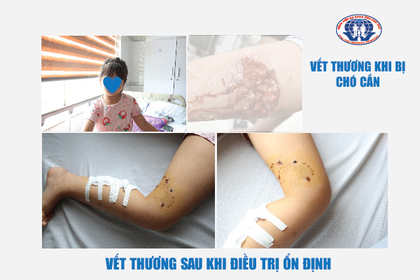 Đời sống - Tin tức Đời sống 27/10: Tắt kịp 5 'quả bom' ẩn trong đầu người phụ nữ