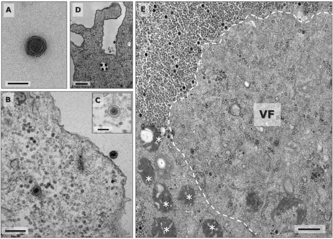 Sức khỏe - Brazil phát hiện virus lạ thường chưa từng biết đến, Nigeria cảnh báo căn bệnh lạ khiến 15 người chết