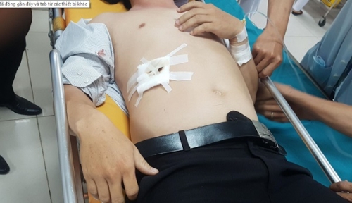 Vụ học sinh đâm thầy giáo trọng thương: Đại diện sở GD&ĐT 'đau lòng' (Hình 2).