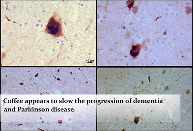Đời sống - Lợi &iacute;ch v&agrave; t&aacute;c hại của c&agrave; ph&ecirc; (H&igrave;nh 5).