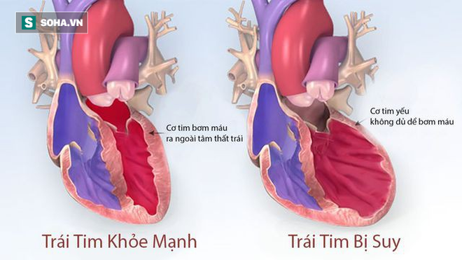 Sức khỏe - Dấu hiệu cảnh báo tim của bạn đã gặp nguy hiểm (Hình 2).