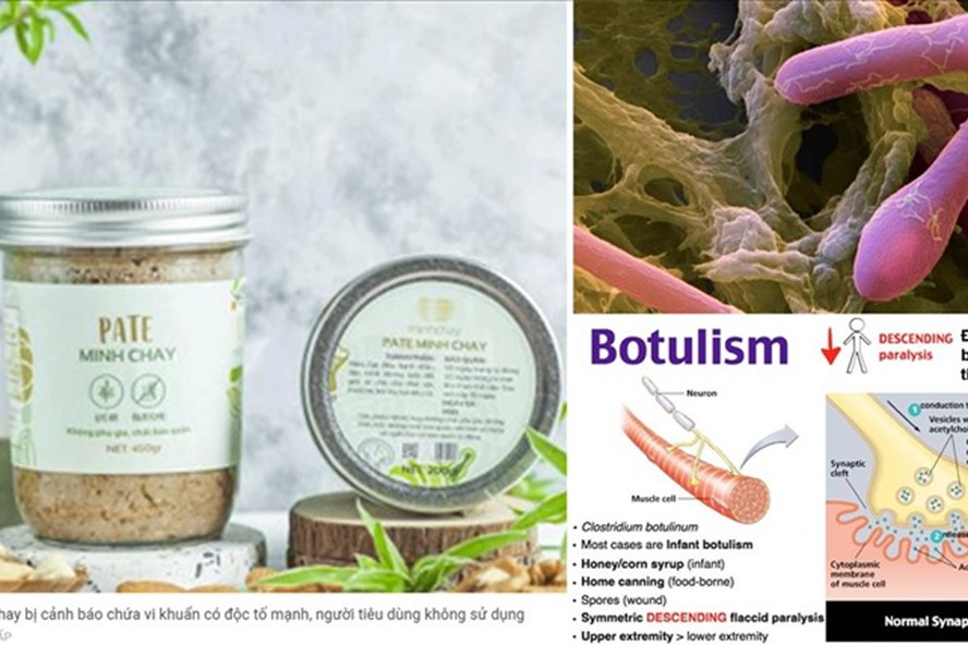 Đời sống - Vi khuẩn Clostridium botulinum được tìm thấy trong Pate Minh Chay chứa độc tố gây chết người 