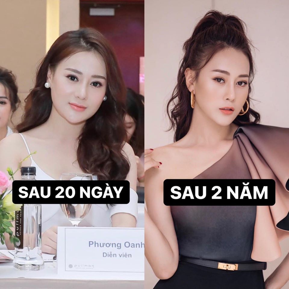 Giải trí - “Gái ngành hot nhất màn ảnh” Phương Oanh: 'Lột xác' ngoạn mục nhờ dao kéo và lời khuyên bất ngờ (Hình 2).