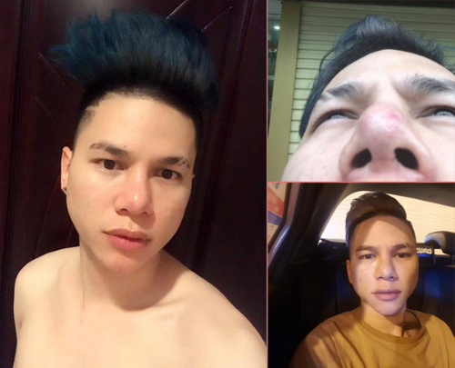 Đời sống - Những vụ nam giới phẫu thuật thẩm mỹ “dậy sóng” dư luận (Hình 3).