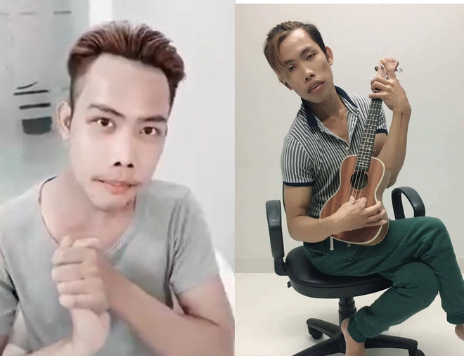 Đời sống - Những vụ nam giới phẫu thuật thẩm mỹ “dậy sóng” dư luận (Hình 4).