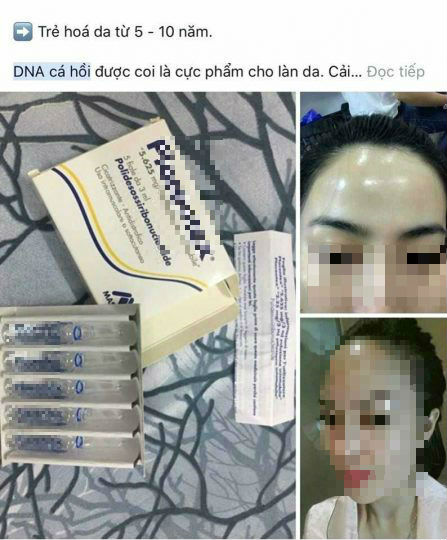 Gia đình - Tiêm tinh chất DNA cá hồi trẻ hóa da: Không nên nhẹ dạ