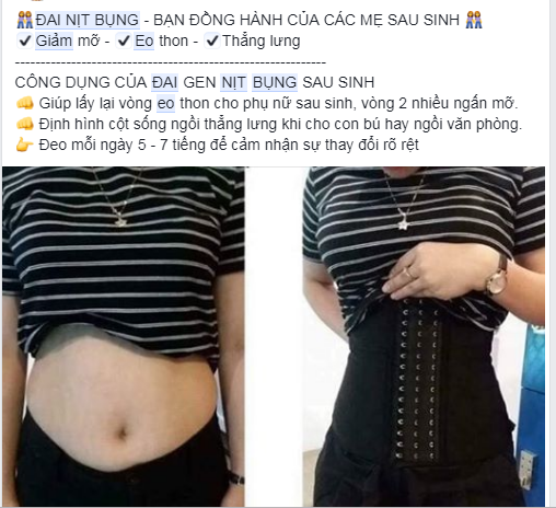 Sức khỏe - Cẩn trọng khi dùng đai nịt bụng lấy lại vóc dáng thon gọn như thời con gái (Hình 2).