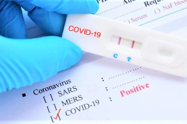 Sự kiện - Bộ Y tế: Cơ sở kinh doanh phải niêm yết giá bán kit test Covid-19
