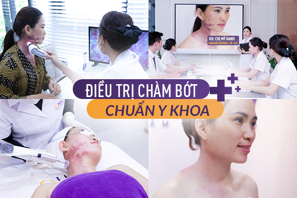 Sức khỏe - 3 yếu tố quyết định giúp điều trị chàm bớt hiệu quả (Hình 2).