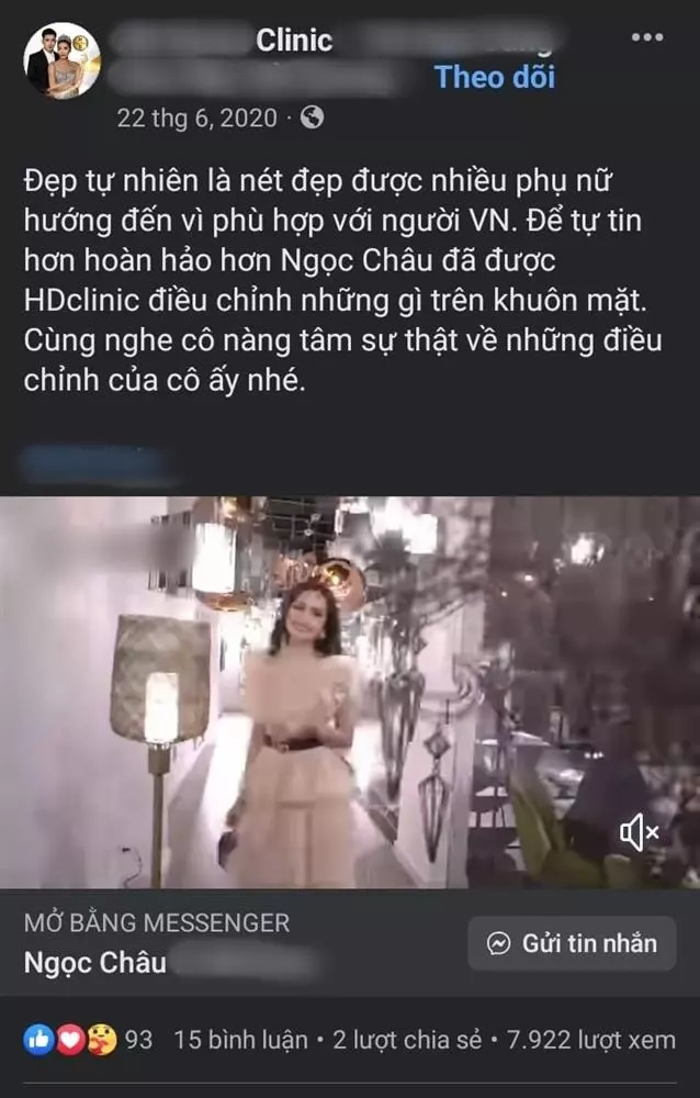 Văn hoá - Khẳng định “thời gian đâu mà phẫu thuật”, Ngọc Châu gây sốt khi lộ ảnh sửa toàn bộ