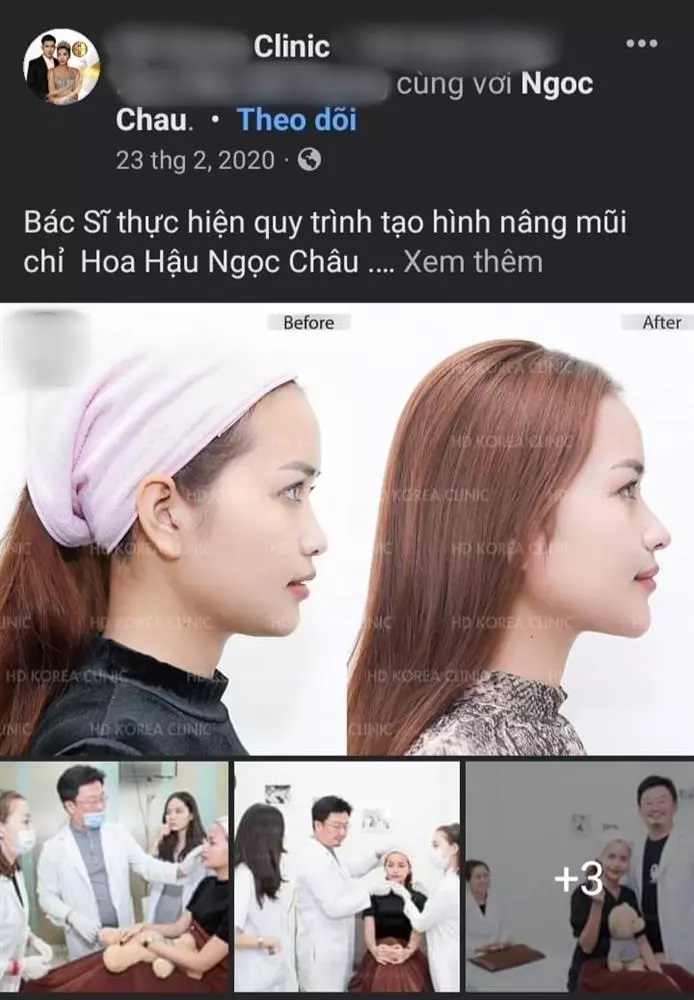 Văn hoá - Khẳng định “thời gian đâu mà phẫu thuật”, Ngọc Châu gây sốt khi lộ ảnh sửa toàn bộ (Hình 2).