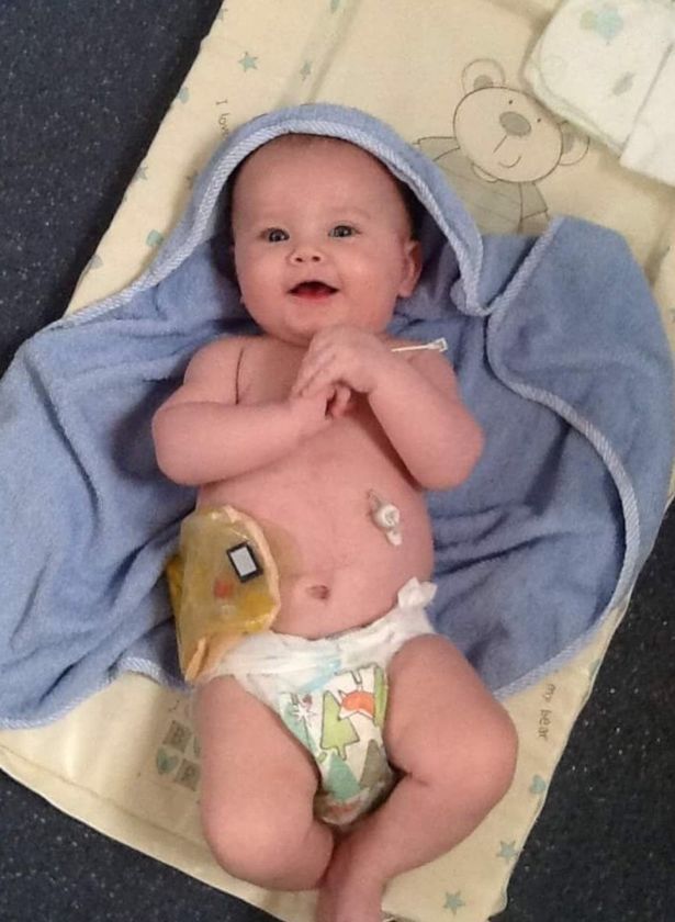 Gia đ&igrave;nh - B&eacute; trai 4 tuổi dũng cảm chiến đấu với 87 ca phẫu thuật (H&igrave;nh 2).