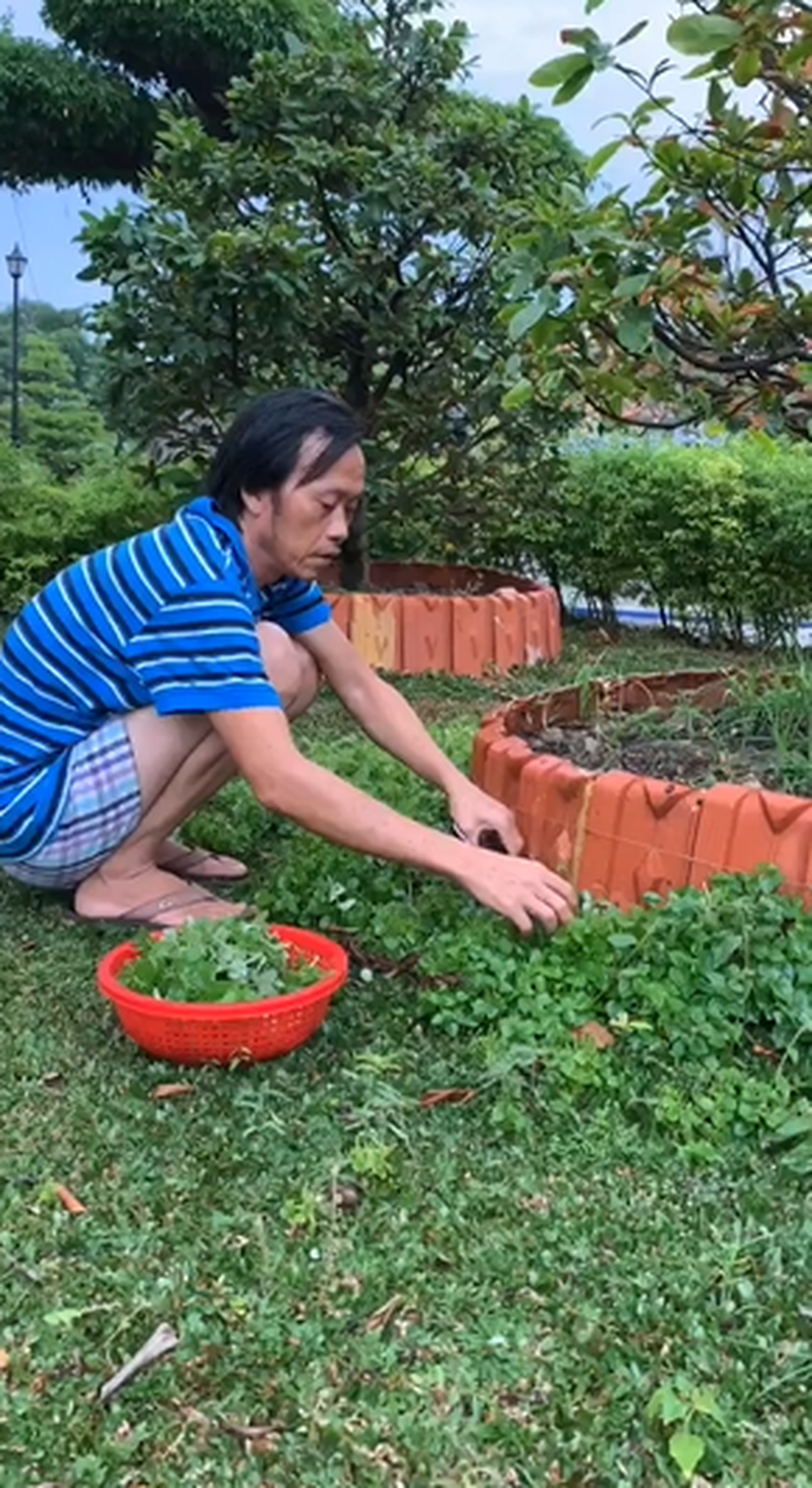 Ngôi sao - Hoài Linh đăng tải hình ảnh chân trái băng bó khiến nhiều người lo lắng (Hình 2).