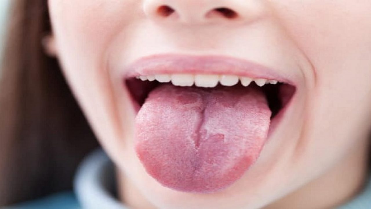 Sức khỏe - Miệng có 4 điểm bất thường này cảnh báo dạ dày đang bị tổn thương (Hình 3).