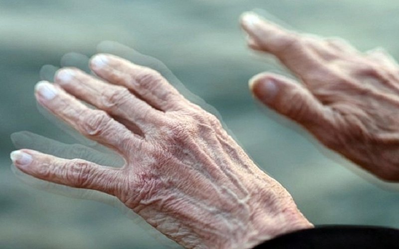 Đời sống - Thấy cơ thể có những thay đổi này cẩn thận mắc Parkinson mà không biết