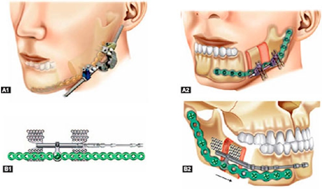 Đời sống - Thiếu nữ 18 tuổi bị teo lép nửa mặt trái vì mắc hội chứng lạ