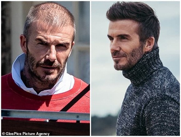 Ngôi sao - Fans sốc với hình ảnh David Beckham 'xuống mã' nghiêm trọng do chứng rụng tóc (Hình 5).