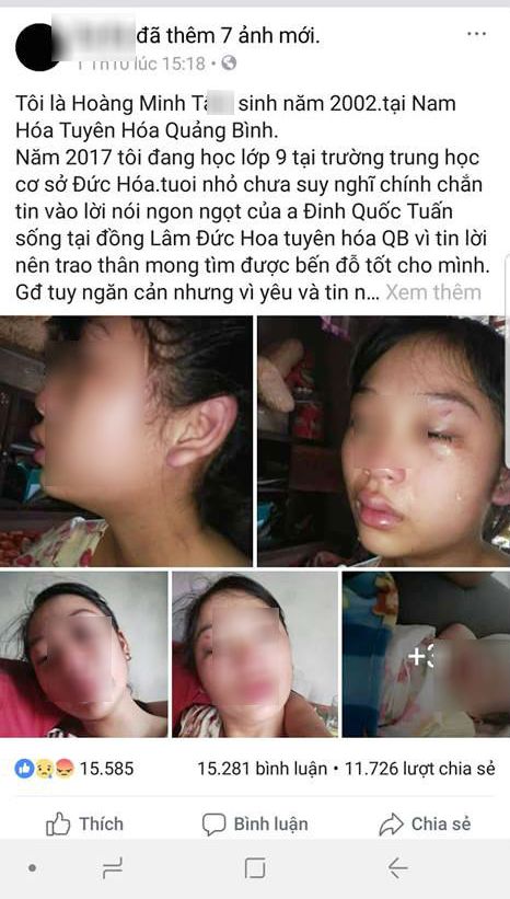 An ninh - Hình sự - Từ vụ cô gái trẻ 16 tuổi tố bị chồng bạo hành: Làm gì để hạn chế tảo hôn?