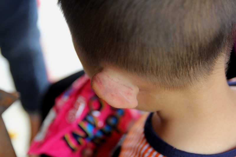 Cha dượng nghi hành hung dã man con riêng của vợ khai gì với công an? (Hình 2).