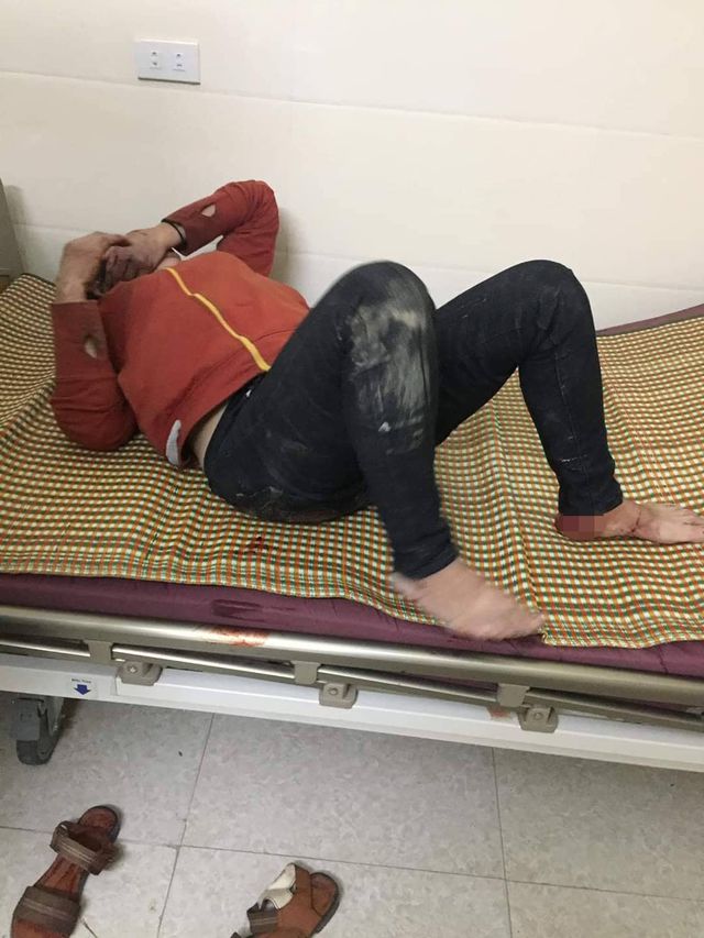 An ninh - Hình sự - Bắt “phi công trẻ” dùng thanh sắt đâm vào vùng kín của người tình lớn tuổi