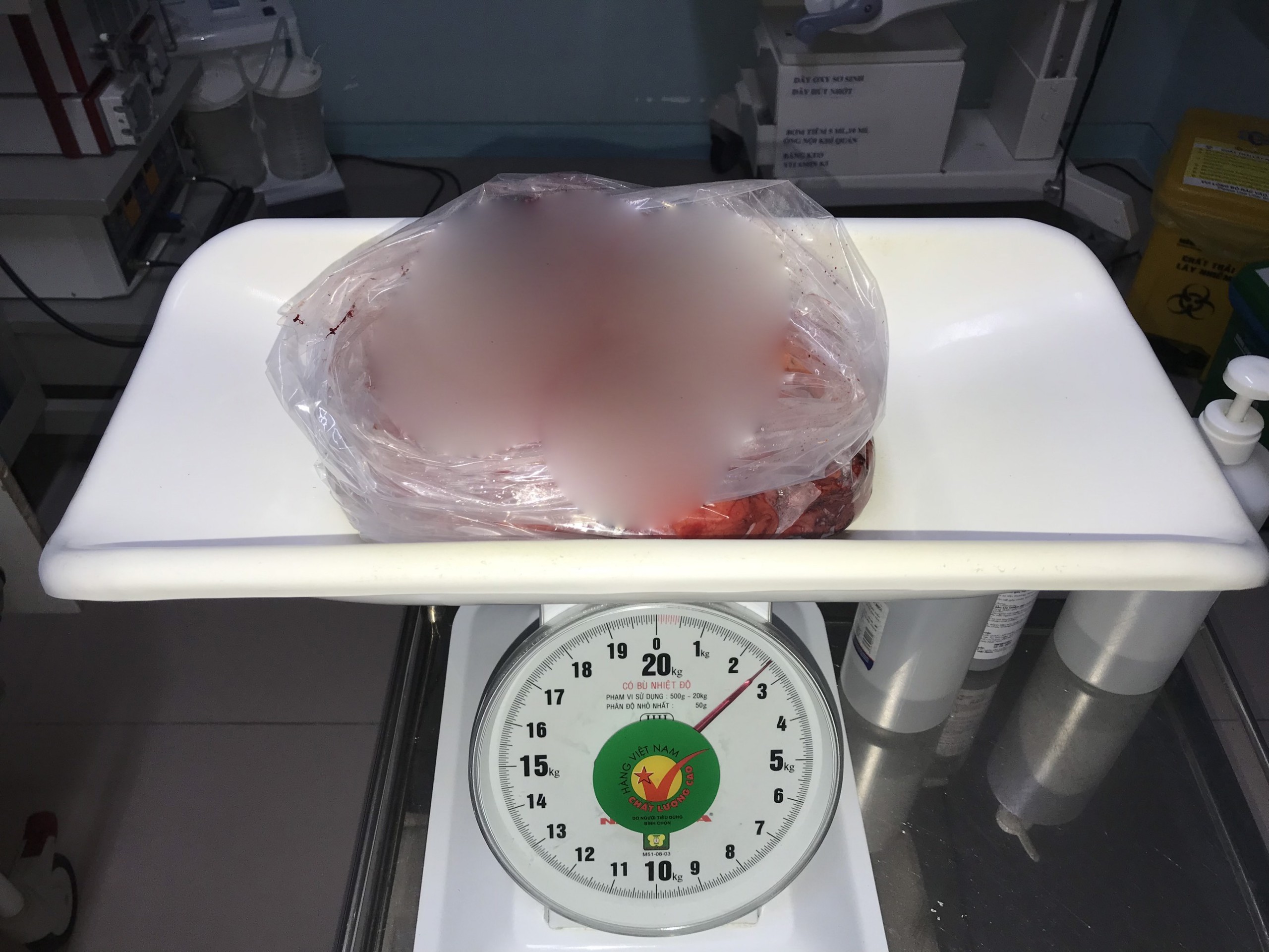 Sức khỏe - Đồng Nai: Cắt bỏ khối u nặng 2,5kg trong ngực người đàn ông (Hình 2).