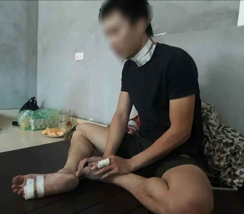An ninh - Hình sự - Kinh hoàng vụ cứa cổ cướp taxi qua lời kể của nạn nhân