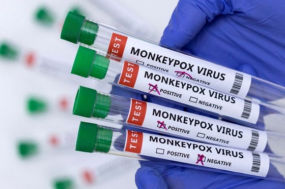 Sức khỏe - Có nên tiêm vaccine đậu mùa khỉ? 