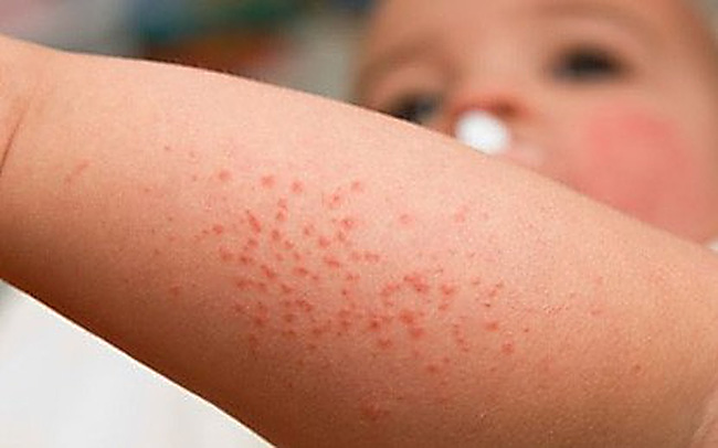 X&atilde; hội - Bản tin 3/4: Trường hợp n&agrave;o được tuyển thẳng v&agrave;o lớp 10? (H&igrave;nh 2).