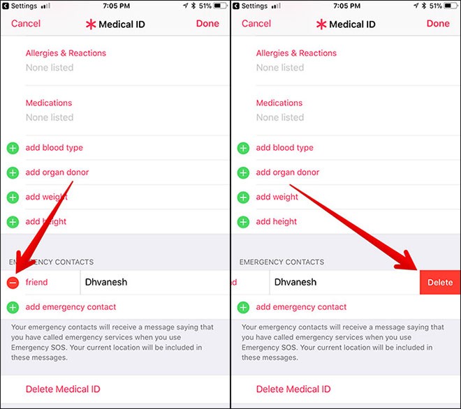 Công nghệ - Thêm và loại bỏ số liên lạc khỏi Emergency SOS trên iPhone (Hình 4).