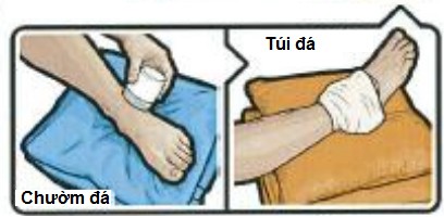 Sức khỏe - 4 nên, 4 tránh khi chấn thương phần mềm