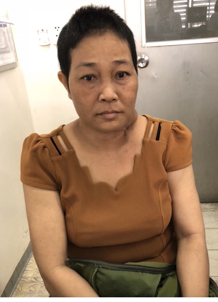 Sức khỏe - Một phụ nữ được phẫu thuật th&agrave;nh c&ocirc;ng khối u v&ugrave;ng cổ khổng lồ hiếm gặp (H&igrave;nh 2).