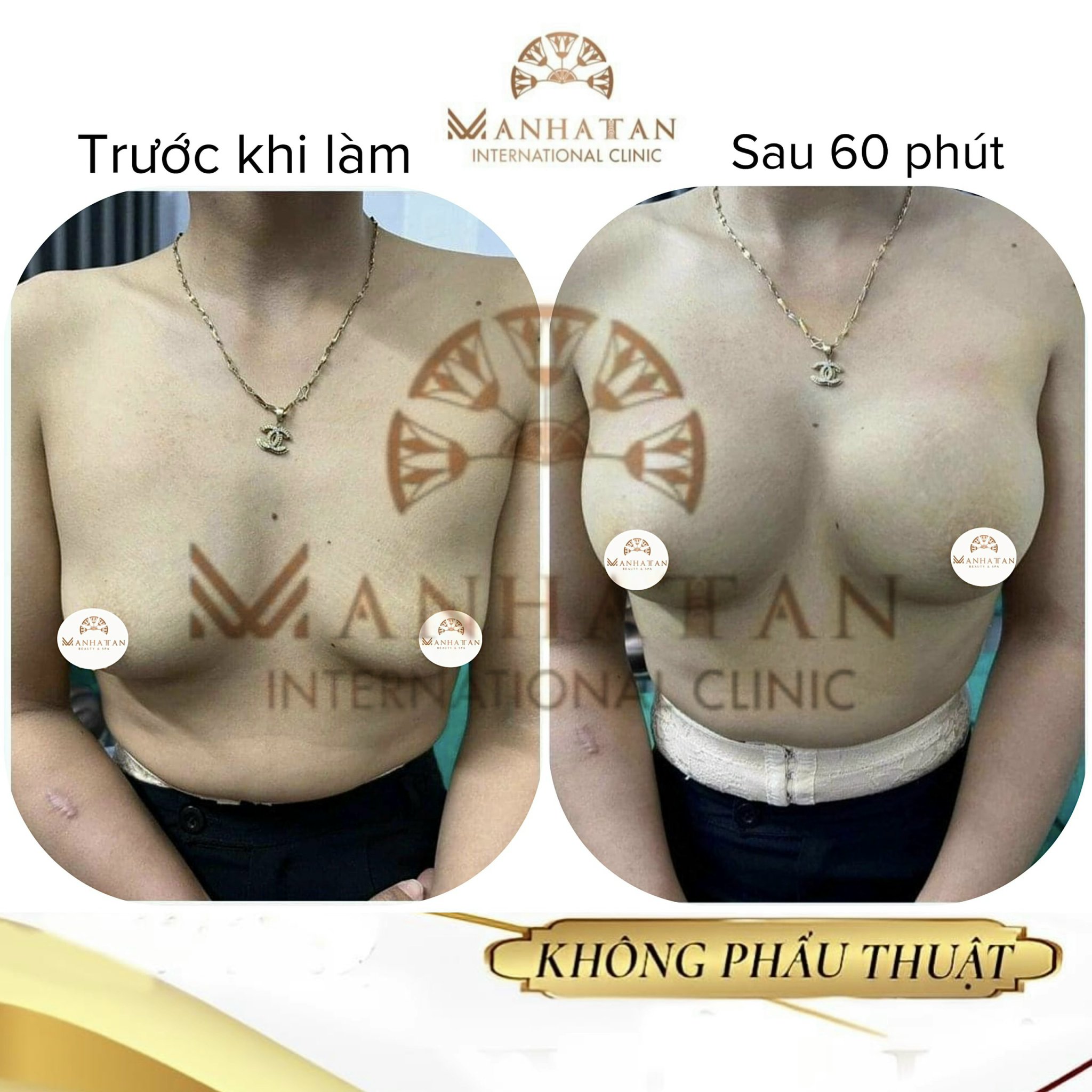 Sức khỏe - Thẩm mỹ viện làm biến chứng ngực bệnh nhân chưa được cấp phép  (Hình 3).