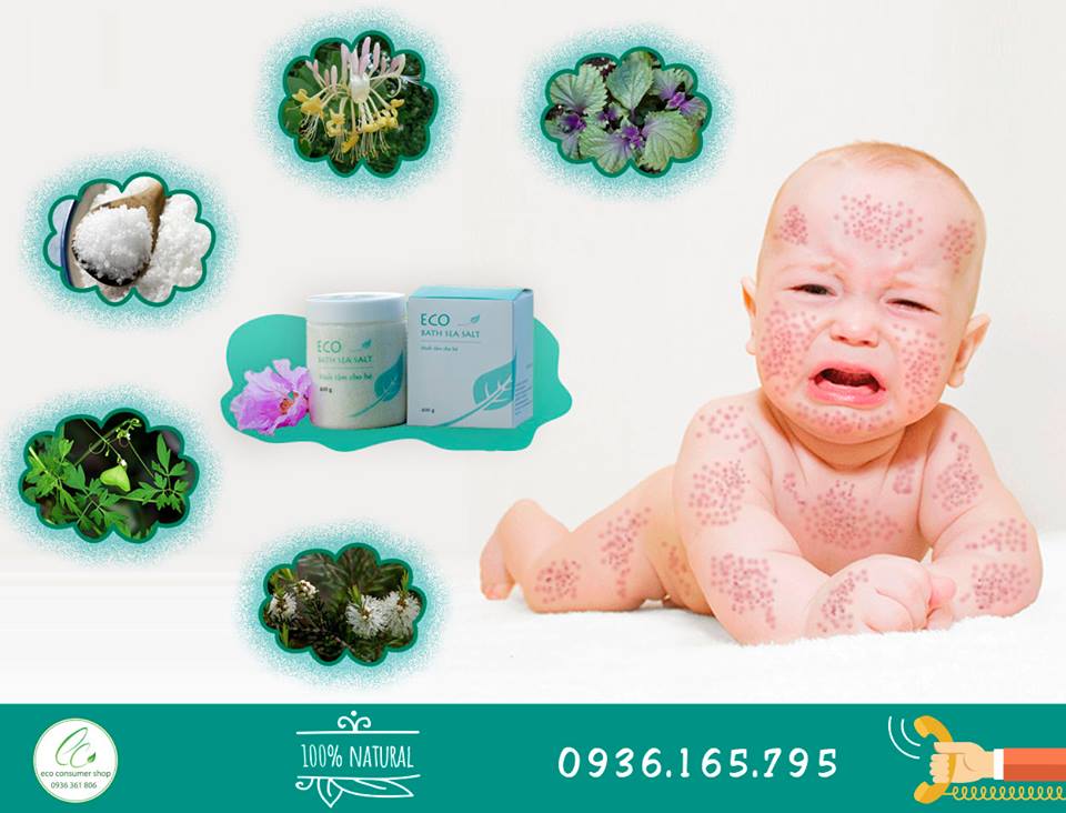 Phòng và điều trị rôm sảy, mẩn ngứa cho trẻ (Hình 2).