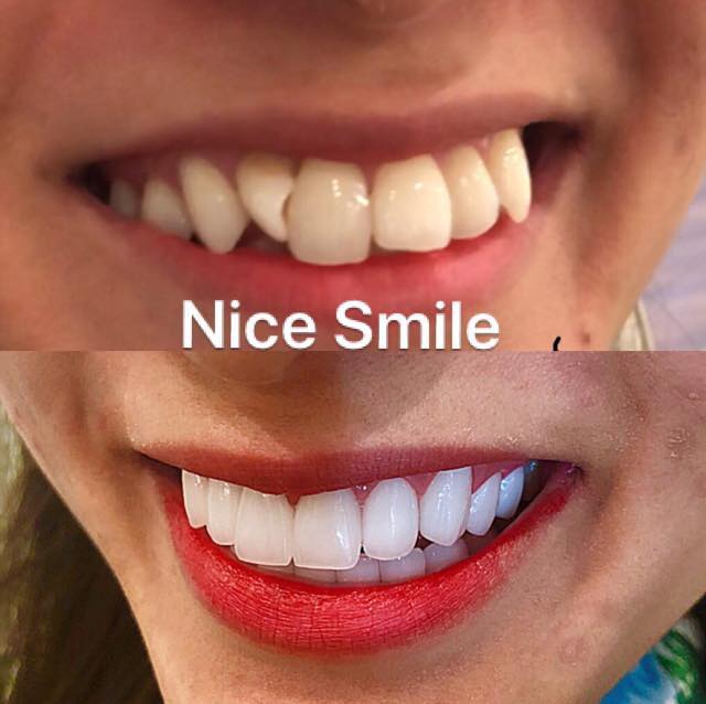 Nice Smile - Sứ mệnh mang tới nụ cười chinh phục con tim (Hình 4).