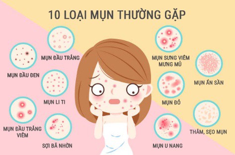 Trị mụn nội tiết - Tưởng khó mà dễ! (Hình 2).