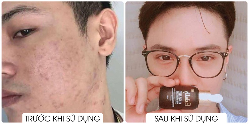 Thải độc tố da hiệu quả tại nhà với Huyết Thanh Tổ Yến (Hình 3).