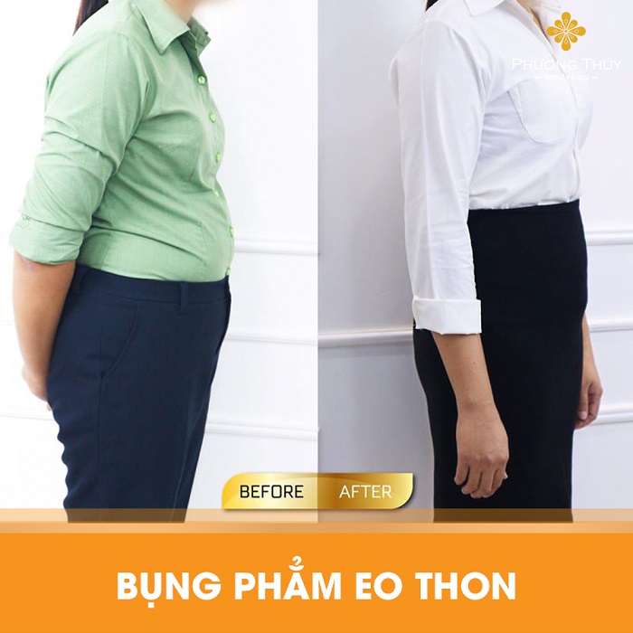 Truyền thông - Giảm cân không phẫu thuật - Xu hướng làm đẹp của tương lai (Hình 6).