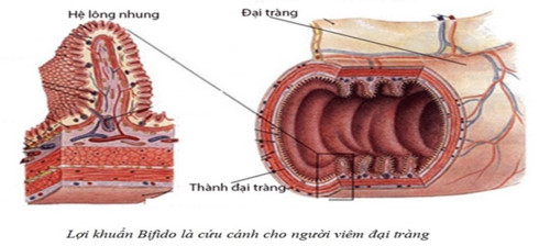 Thương hiệu - Bí quyết 'vàng' giúp nam giới đẩy lùi viêm đại tràng do bia rượu (Hình 2).