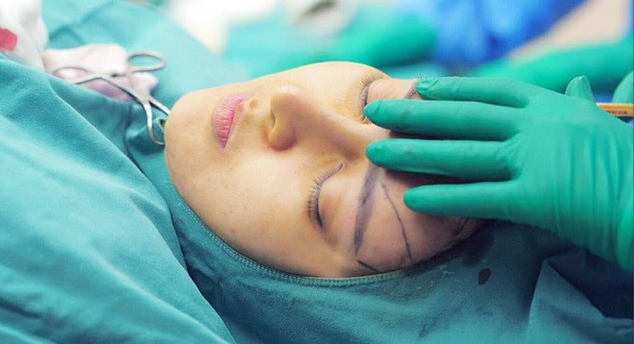 Truyền thông - Chăm sóc sau cấy mỡ mặt như thế nào để đạt hiệu quả hoàn mỹ? (Hình 2).
